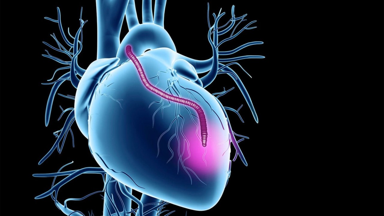 COVID Patients at Risk for 20 Cardiovascular Diseases